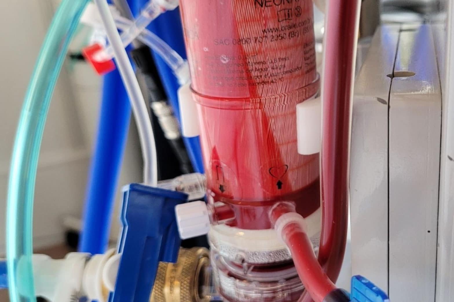 Theraklinik Long COVID Blutwäsche – Blut wird im Oxygenator mit Sauerstoff aufgesättigt